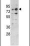 Zinc Finger And BTB Domain Containing 16 antibody, PA5-13618, Invitrogen Antibodies, Western Blot image 