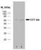 Chaperonin Containing TCP1 Subunit 7 antibody, SM2019P, Origene, Western Blot image 