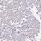 Keratinocyte Associated Protein 3 antibody, HPA047136, Atlas Antibodies, Immunohistochemistry paraffin image 