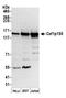 Chromatin Assembly Factor 1 Subunit A antibody, A301-482A, Bethyl Labs, Western Blot image 