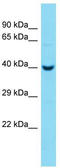 Protein-L-Isoaspartate (D-Aspartate) O-Methyltransferase Domain Containing 2 antibody, TA346795, Origene, Western Blot image 