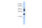 F-Box And Leucine Rich Repeat Protein 2 antibody, ARP43096_P050, Aviva Systems Biology, Western Blot image 