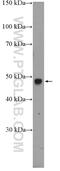 Ribosomal protein S6 modification-like protein B antibody, 26111-1-AP, Proteintech Group, Western Blot image 