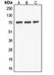 ATP Binding Cassette Subfamily F Member 2 antibody, LS-C353226, Lifespan Biosciences, Western Blot image 