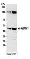 Proteasomal ubiquitin receptor ADRM1 antibody, A302-555A, Bethyl Labs, Western Blot image 
