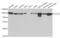 Chloride Voltage-Gated Channel 5 antibody, PA5-76761, Invitrogen Antibodies, Western Blot image 