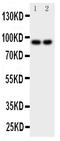 MALT1 antibody, PA1920, Boster Biological Technology, Western Blot image 