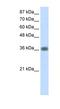 Kelch Domain Containing 8A antibody, NBP1-57422, Novus Biologicals, Western Blot image 
