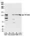 Cullin Associated And Neddylation Dissociated 2 (Putative) antibody, A304-046A, Bethyl Labs, Western Blot image 