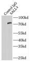 Sal-like protein 4 antibody, FNab07583, FineTest, Immunoprecipitation image 
