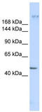 Myoferlin antibody, TA341923, Origene, Western Blot image 