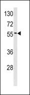 Epsin 3 antibody, PA5-13460, Invitrogen Antibodies, Western Blot image 