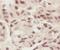 Histone Cluster 4 H4 antibody, FNab03889, FineTest, Immunohistochemistry paraffin image 