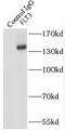 Fms Related Tyrosine Kinase 3 antibody, FNab03164, FineTest, Immunoprecipitation image 