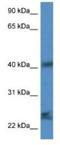Secretory Carrier Membrane Protein 1 antibody, NBP1-79765, Novus Biologicals, Western Blot image 