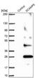 Secretory carrier-associated membrane protein 5 antibody, PA5-61269, Invitrogen Antibodies, Western Blot image 