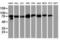 Progressive ankylosis protein antibody, orb314118, Biorbyt, Western Blot image 