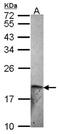 ET-2 antibody, NBP2-16333, Novus Biologicals, Western Blot image 