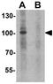 N-Deacetylase And N-Sulfotransferase 2 antibody, GTX32135, GeneTex, Western Blot image 
