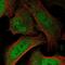 Bromodomain Adjacent To Zinc Finger Domain 2B antibody, NBP2-57156, Novus Biologicals, Immunofluorescence image 