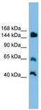 JMJ antibody, TA342348, Origene, Western Blot image 