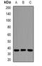 Protein Kinase AMP-Activated Non-Catalytic Subunit Beta 2 antibody, orb381985, Biorbyt, Western Blot image 