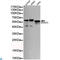 SMAD Family Member 5 antibody, LS-C814122, Lifespan Biosciences, Western Blot image 