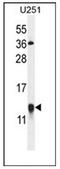 Galectin 1 antibody, AP51860PU-N, Origene, Western Blot image 