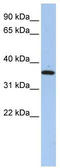 LRAT Domain Containing 1 antibody, TA340391, Origene, Western Blot image 