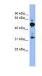 Membrane Palmitoylated Protein 2 antibody, NBP1-54861, Novus Biologicals, Western Blot image 