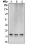 Cerebellin 4 Precursor antibody, MBS821825, MyBioSource, Western Blot image 