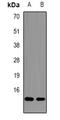 Calcitonin Related Polypeptide Beta antibody, orb341432, Biorbyt, Western Blot image 