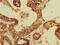 DDB1 And CUL4 Associated Factor 8 antibody, CSB-PA725896HA01HU, Cusabio, Immunohistochemistry paraffin image 