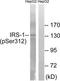 Insulin Receptor Substrate 1 antibody, TA312868, Origene, Western Blot image 