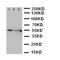 Solute Carrier Family 2 Member 5 antibody, LS-C312888, Lifespan Biosciences, Western Blot image 