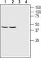 GDNF family receptor alpha-1 antibody, TA328908, Origene, Western Blot image 