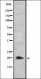 Calcyon Neuron Specific Vesicular Protein antibody, orb337735, Biorbyt, Western Blot image 
