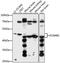 Potassium Voltage-Gated Channel Subfamily A Member Regulatory Beta Subunit 1 antibody, 15-994, ProSci, Western Blot image 