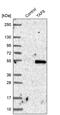TATA-Box Binding Protein Associated Factor 8 antibody, PA5-56838, Invitrogen Antibodies, Western Blot image 