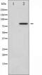 Glucocorticoid receptor antibody, TA325750, Origene, Western Blot image 