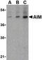 CD5 Molecule Like antibody, GTX41902, GeneTex, Western Blot image 