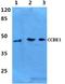 Collagen And Calcium Binding EGF Domains 1 antibody, A01950, Boster Biological Technology, Western Blot image 