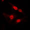 Diacylglycerol kinase alpha antibody, GTX55856, GeneTex, Immunocytochemistry image 