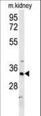 Hydroxysteroid 17-Beta Dehydrogenase 13 antibody, LS-C167386, Lifespan Biosciences, Western Blot image 