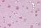 Norrin Cystine Knot Growth Factor NDP antibody, NBP1-59305, Novus Biologicals, Immunohistochemistry frozen image 