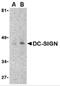 CD209 antibody, PM-2348, ProSci, Western Blot image 