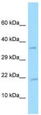 Platelet-derived growth factor subunit A antibody, TA343338, Origene, Western Blot image 