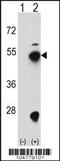 FPS antibody, TA324717, Origene, Western Blot image 