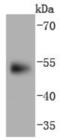 Paired Box 6 antibody, NBP2-67823, Novus Biologicals, Western Blot image 