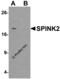 Serine Peptidase Inhibitor, Kazal Type 2 antibody, 6667, ProSci, Western Blot image 